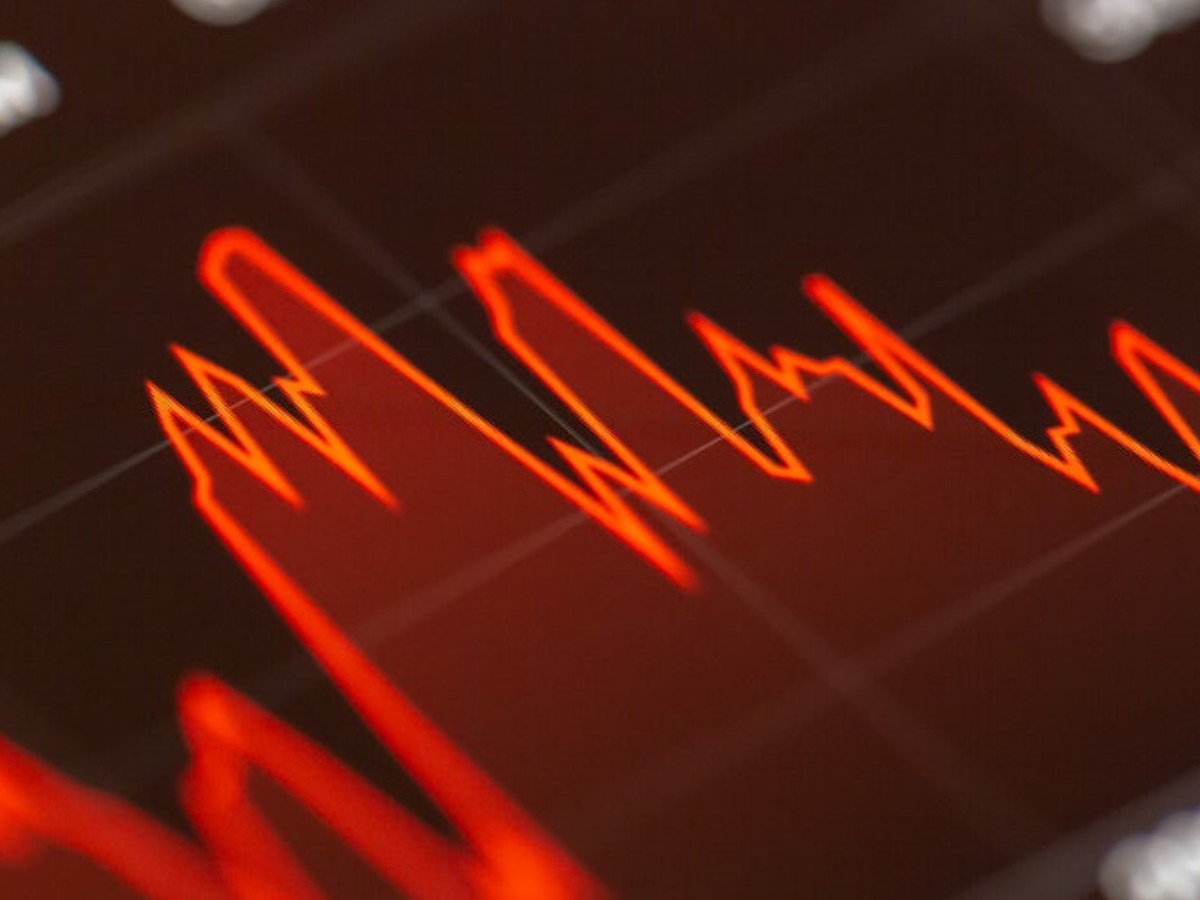 Asian shares extend losses as the war with Iran widens