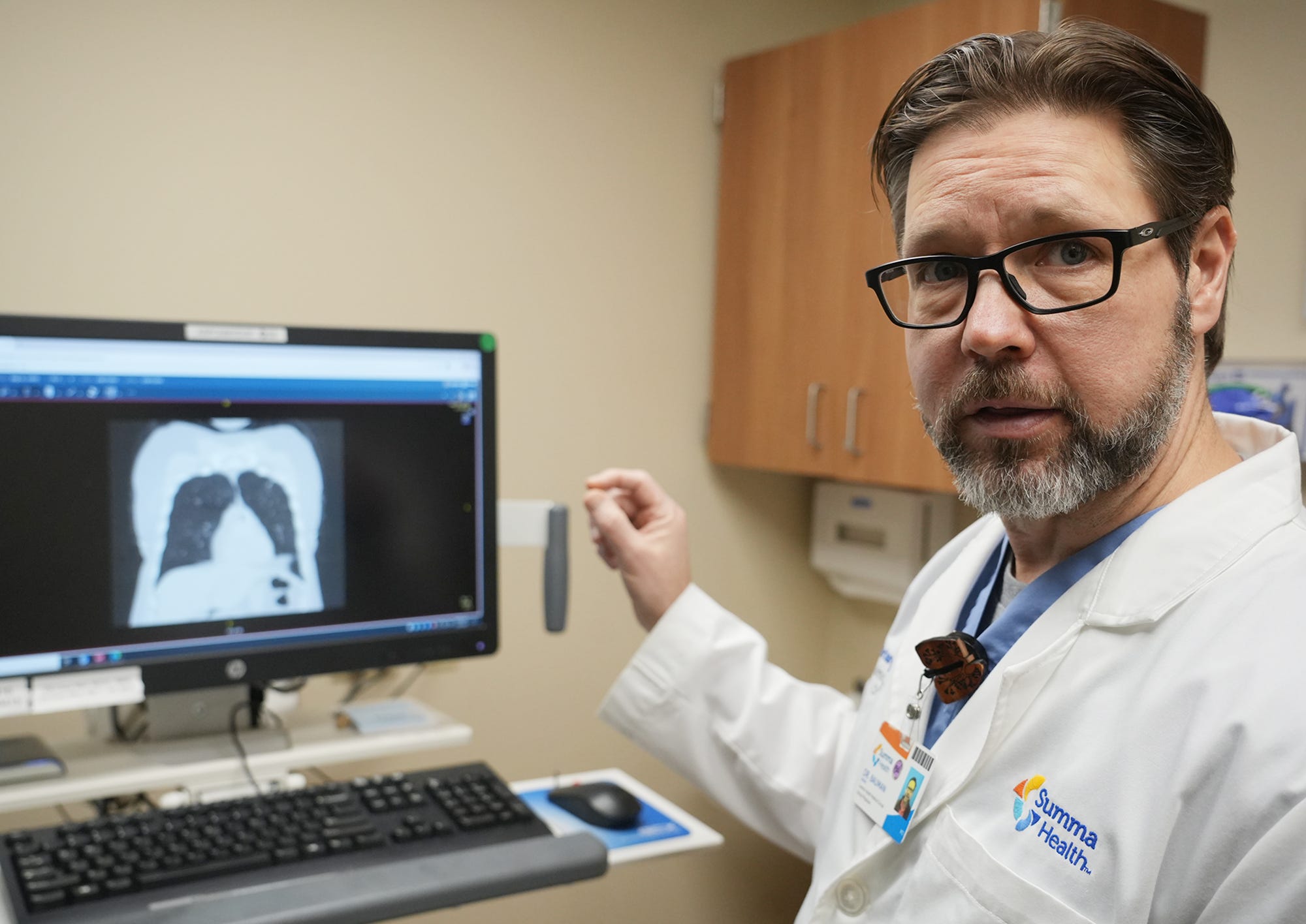 Los radiólogos del noreste de Ohio están utilizando IA. Qué podría significar para ti: